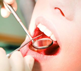 予防に特化歯周病治療